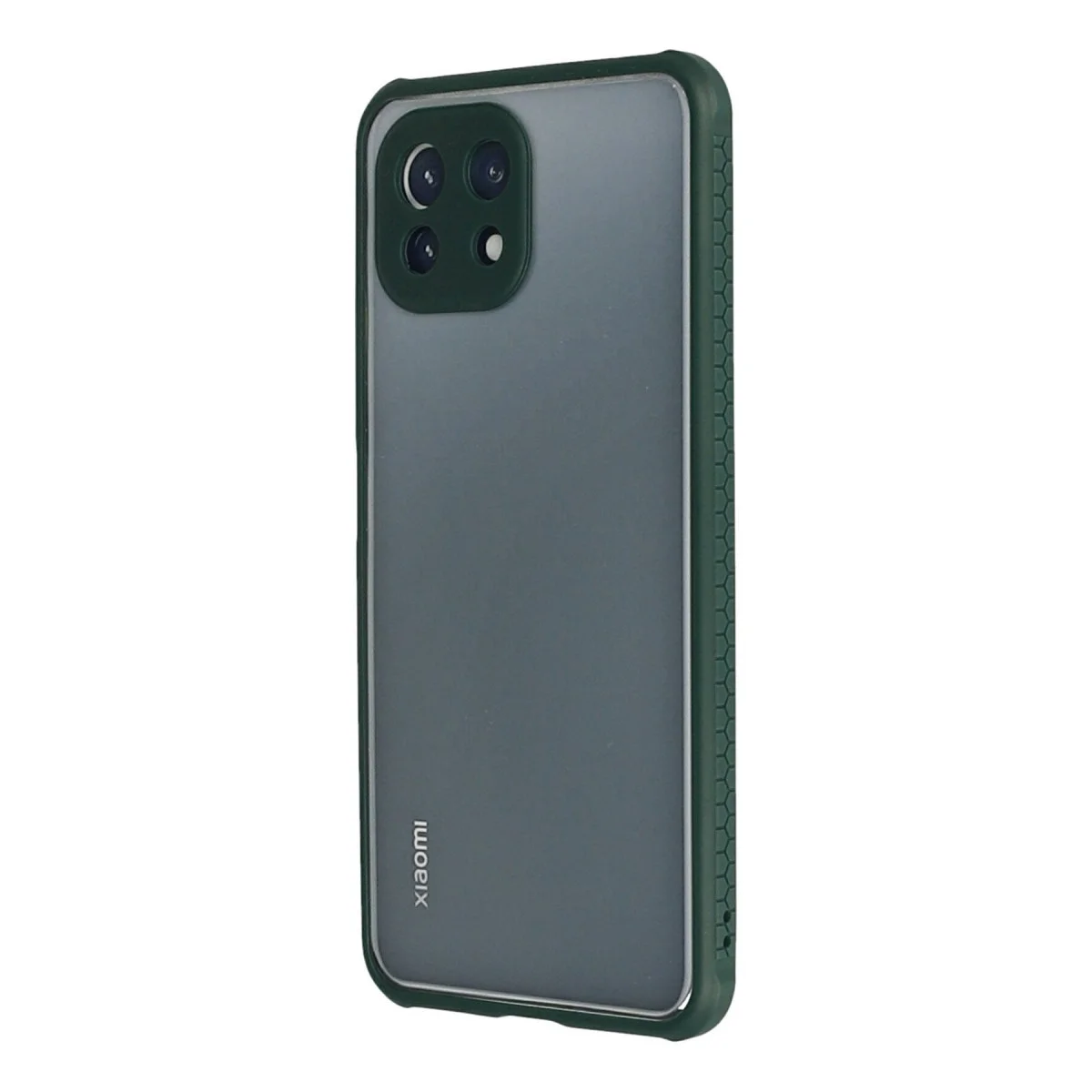 Xiaomi Mi 11 Lite Kılıf Miami Şeffaf Silikon - Koyu Yeşil görsel 3