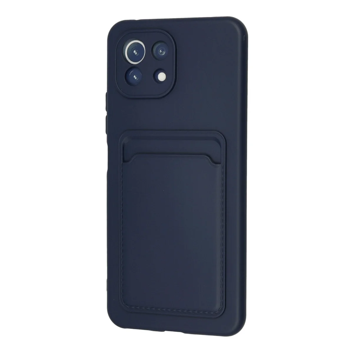 Xiaomi Mi 11 Kılıf Kelvin Kartvizitli Silikon - Lacivert görsel 3