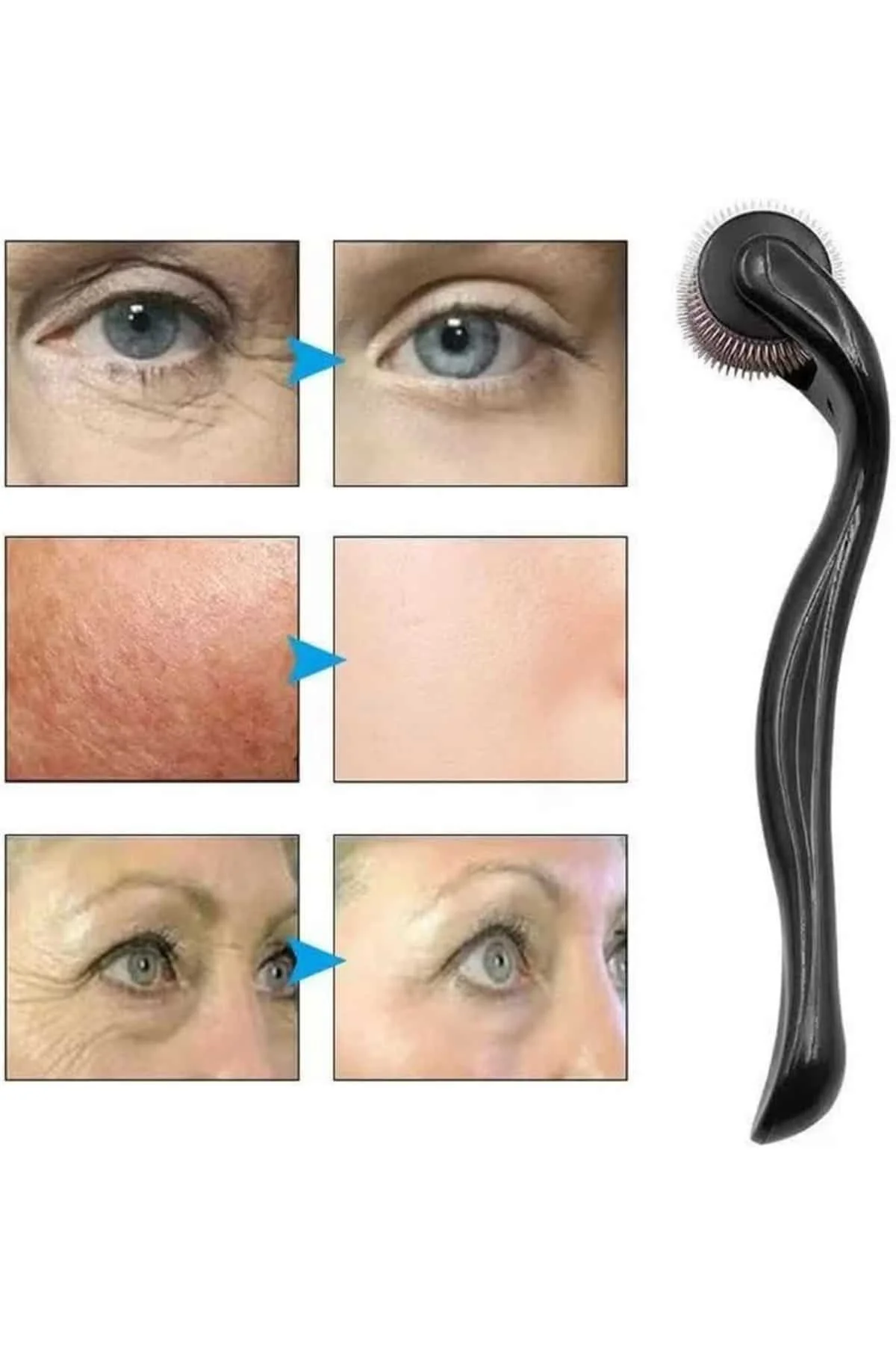 Dermaroller Titanyum 540 Iğneli 1 Mm Saç Kaş Sakal Serum Kullanıma Uygun görsel 3