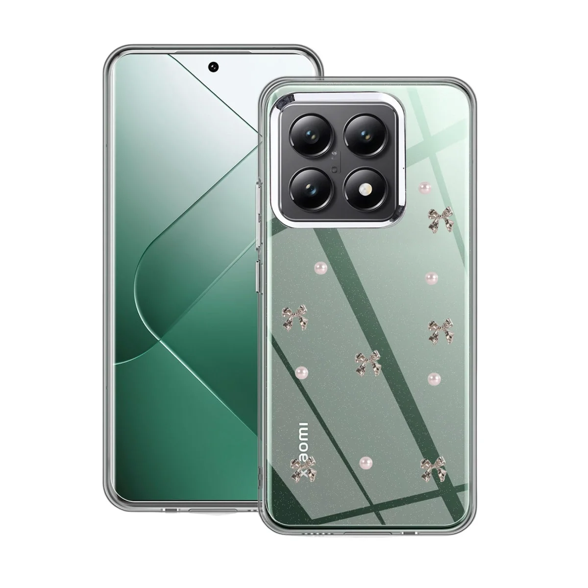 Xiao 14t Pro Fiyonk Desenli Kapak - Desen 8