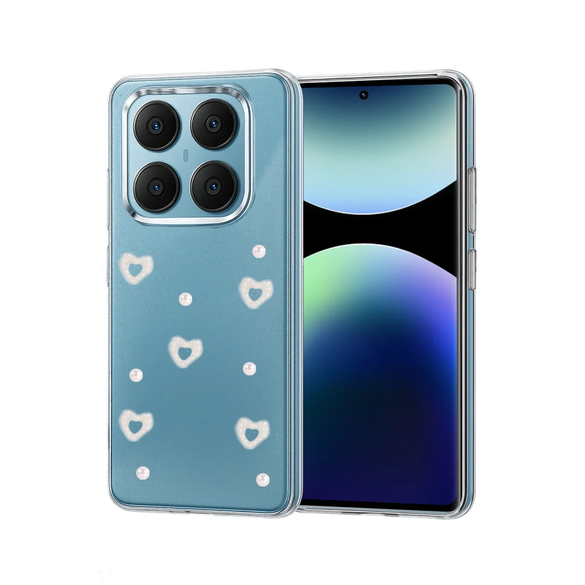 Xiao Red Note 14 Pro 4g Fiyonk Desenli Kapak - Desen 10