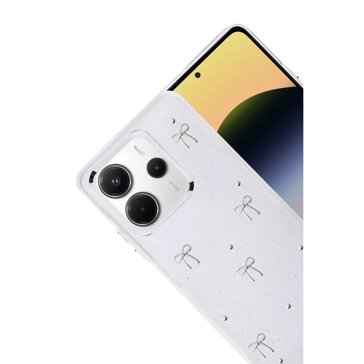 Xiao Red Note 14 4g Fiyonk Desenli Kapak - Desen 5 görsel 2