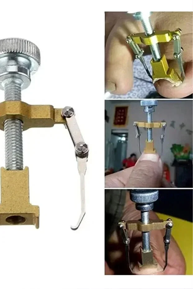 Batık Tırnak Çıkartıcı Çelik Batan Tırnağı Düzeltme Aparatı Düzeltici Aleti Çıkarıcı Aparat görsel 3
